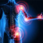 douleurs inflammations neuropathies